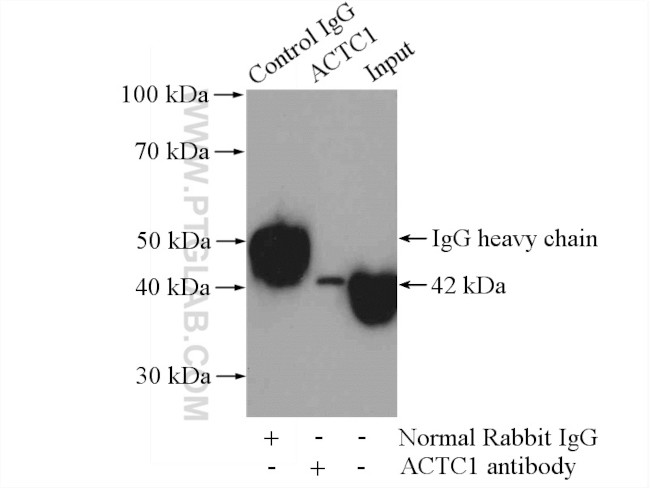 alpha Actin Antibody in Immunoprecipitation (IP)