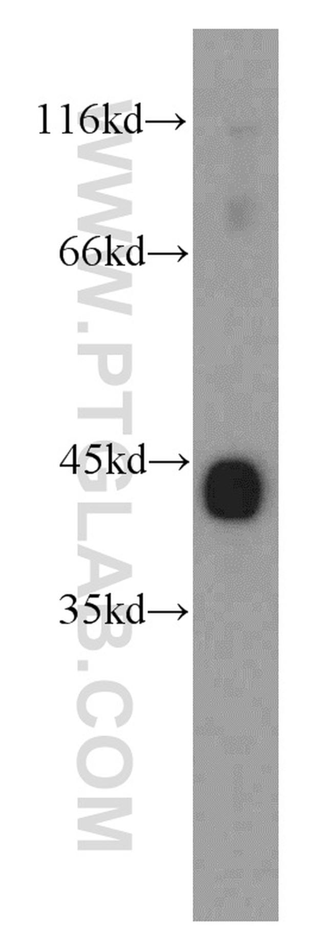 alpha Actin Antibody in Western Blot (WB)