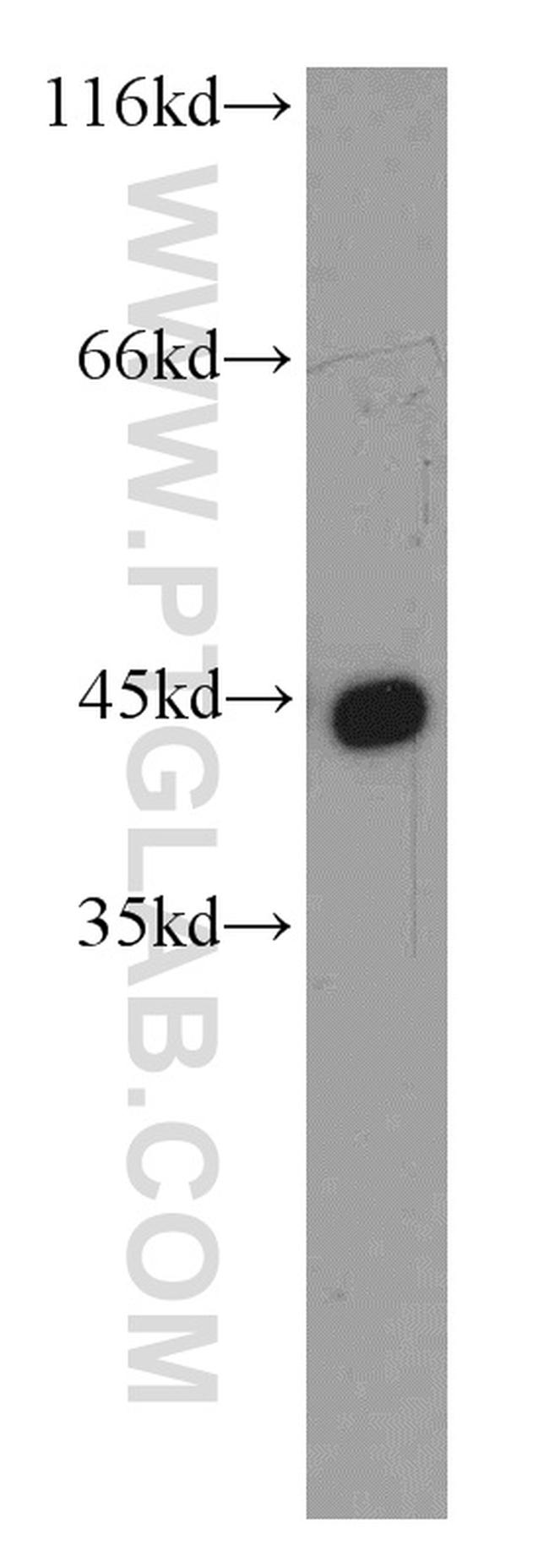 alpha Actin Antibody in Western Blot (WB)