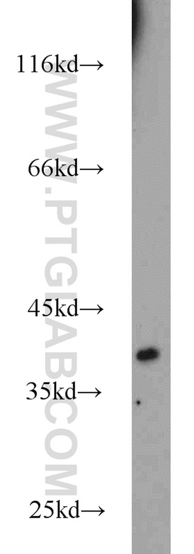 EIF2B2 Antibody in Western Blot (WB)