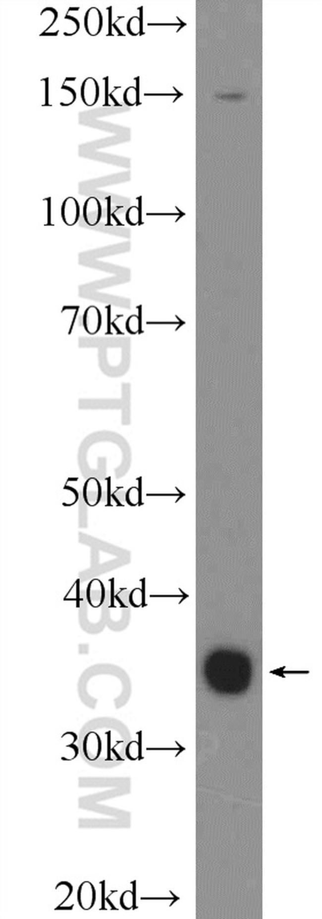 EIF2B2 Antibody in Western Blot (WB)