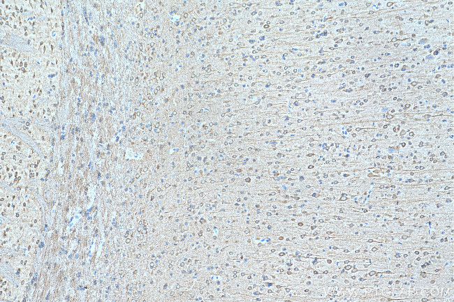 EIF2B2 Antibody in Immunohistochemistry (Paraffin) (IHC (P))