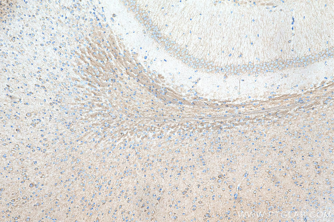 EIF2B2 Antibody in Immunohistochemistry (Paraffin) (IHC (P))