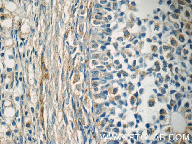 EIF2B2 Antibody in Immunohistochemistry (Paraffin) (IHC (P))