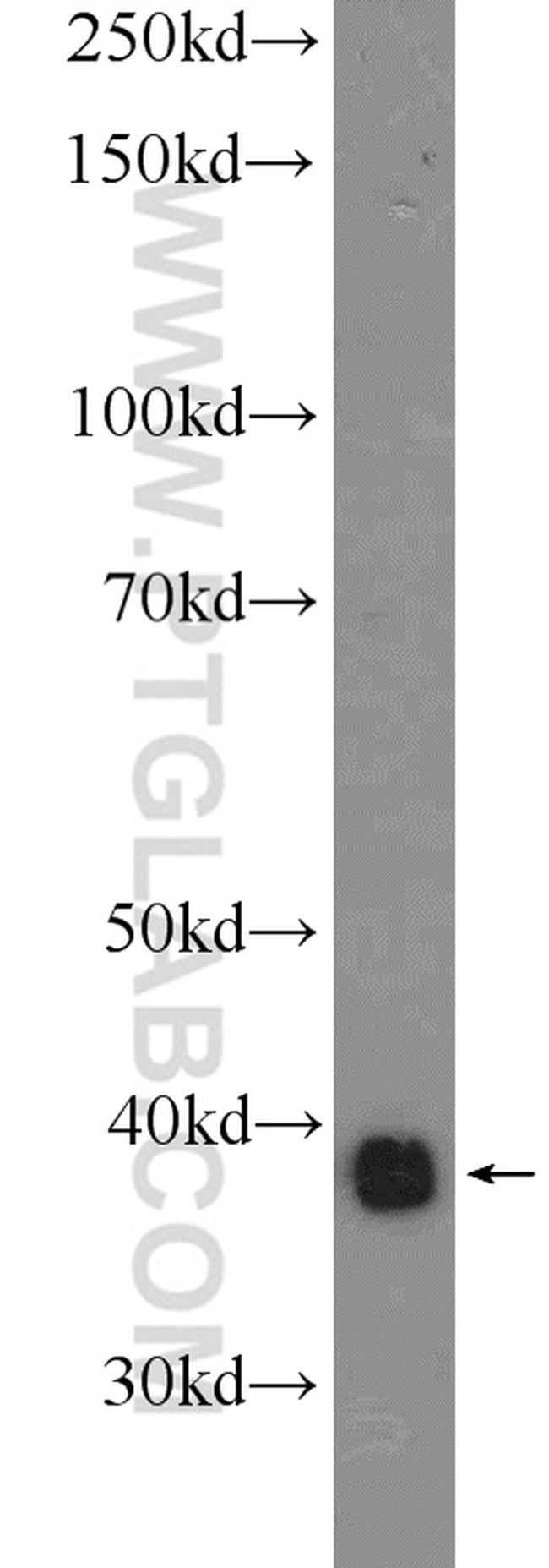 EIF2B2 Antibody in Western Blot (WB)