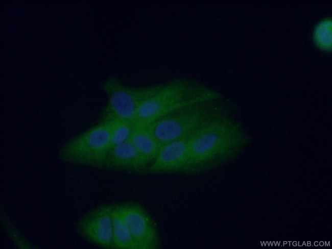 HPGD Antibody in Immunocytochemistry (ICC/IF)