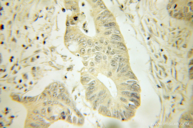 HPGD Antibody in Immunohistochemistry (Paraffin) (IHC (P))