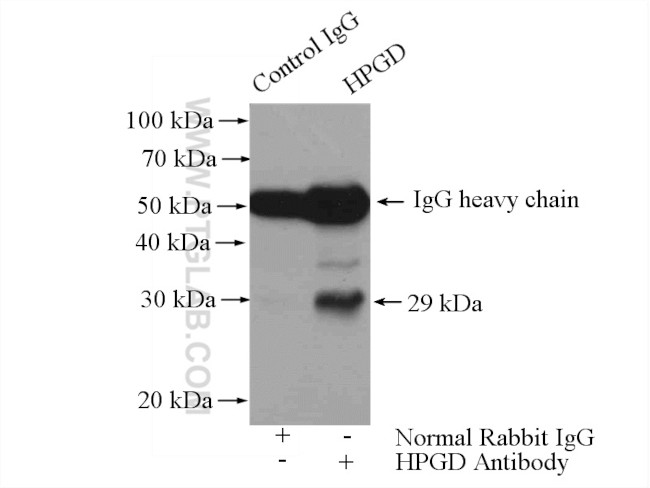 HPGD Antibody in Immunoprecipitation (IP)