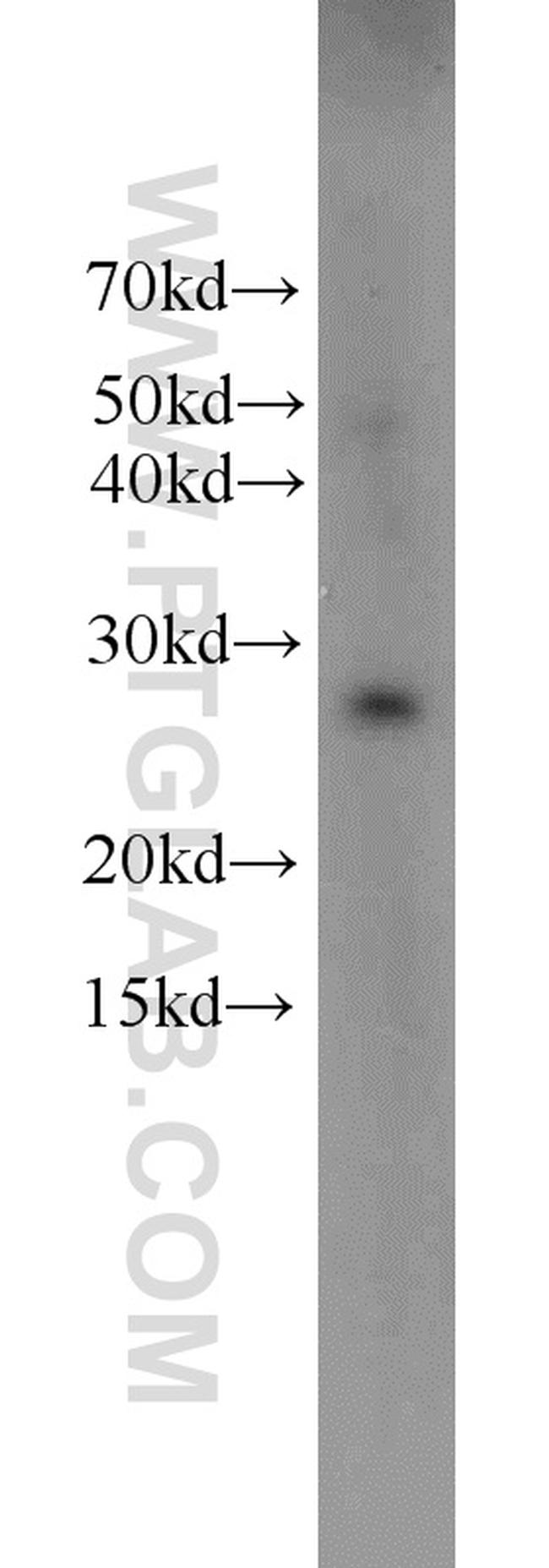 HPGD Antibody in Western Blot (WB)