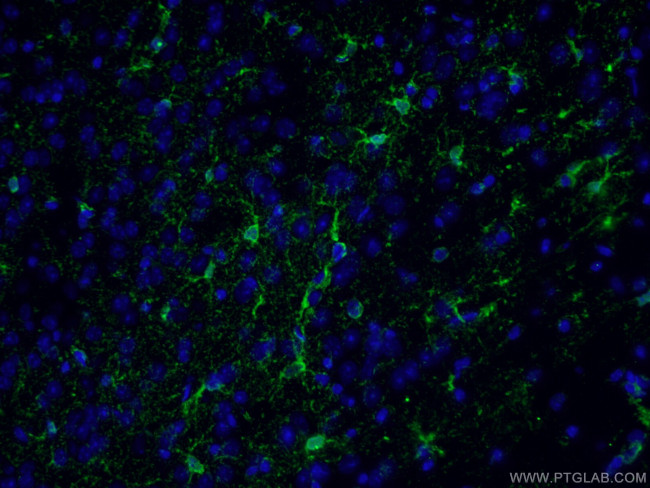 Glutamine synthetase Antibody in Immunohistochemistry (PFA fixed) (IHC (PFA))