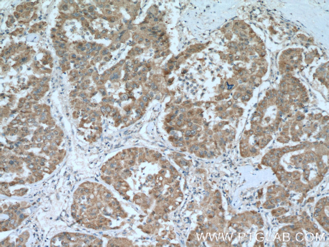 Glutamine synthetase Antibody in Immunohistochemistry (Paraffin) (IHC (P))