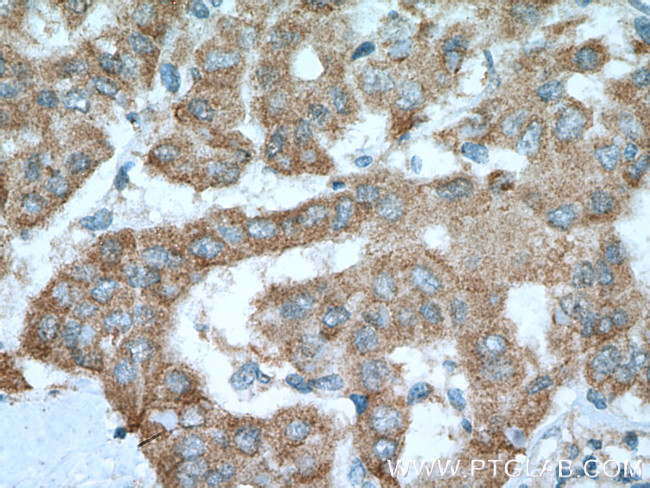 Glutamine synthetase Antibody in Immunohistochemistry (Paraffin) (IHC (P))