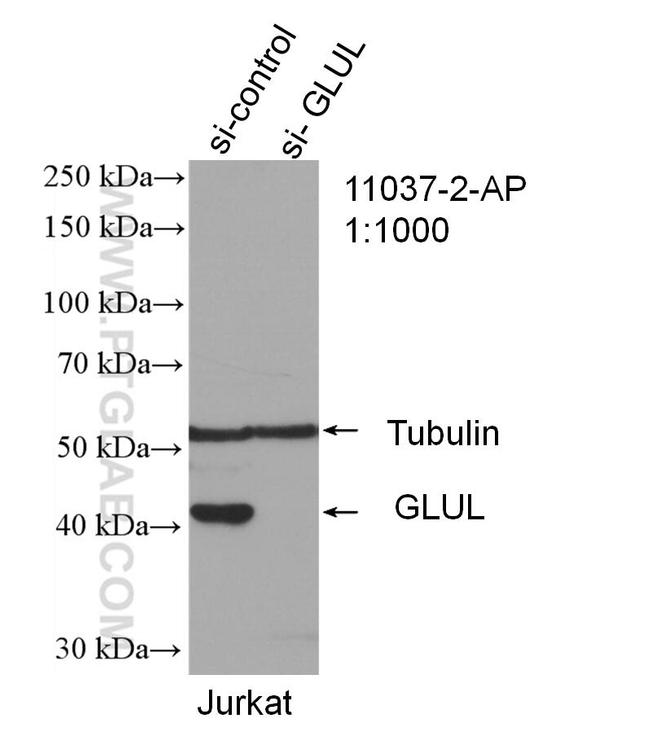 Glutamine synthetase Antibody in Western Blot (WB)