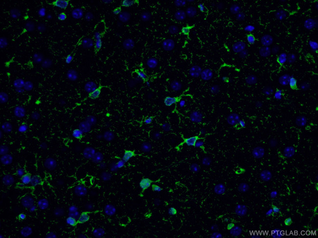 Glutamine synthetase Antibody in Immunohistochemistry (PFA fixed) (IHC (PFA))