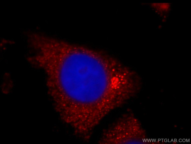 TPM2 Antibody in Immunocytochemistry (ICC/IF)