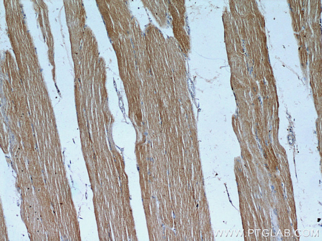 TPM2 Antibody in Immunohistochemistry (Paraffin) (IHC (P))