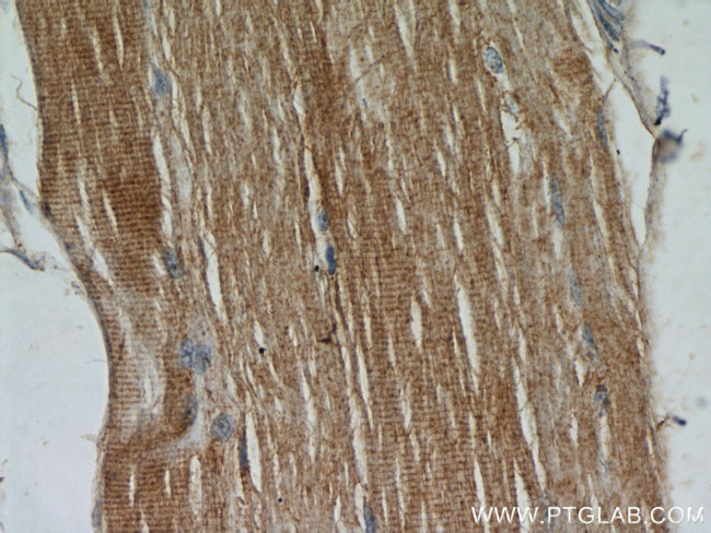 TPM2 Antibody in Immunohistochemistry (Paraffin) (IHC (P))