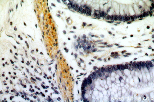 TPM2 Antibody in Immunohistochemistry (Paraffin) (IHC (P))