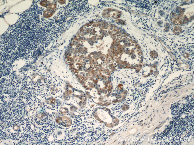 TPM2 Antibody in Immunohistochemistry (Paraffin) (IHC (P))