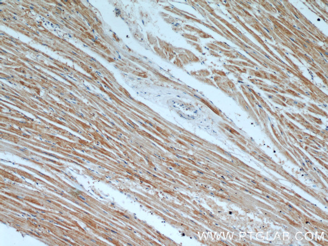 TPM2 Antibody in Immunohistochemistry (Paraffin) (IHC (P))