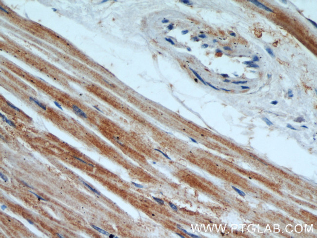 TPM2 Antibody in Immunohistochemistry (Paraffin) (IHC (P))