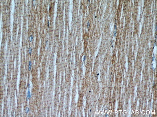 TPM2 Antibody in Immunohistochemistry (Paraffin) (IHC (P))