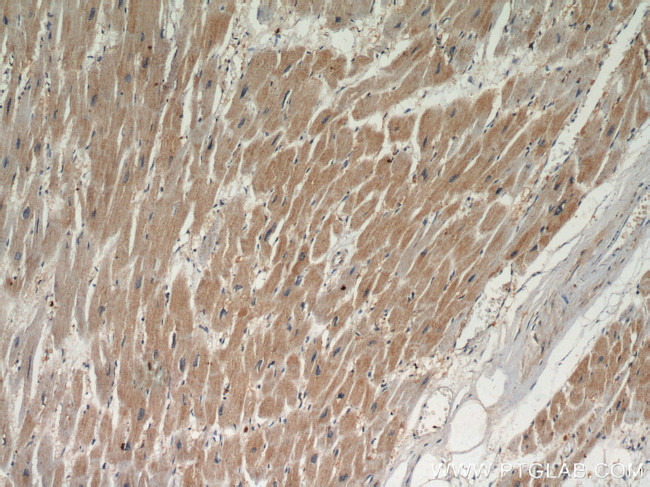 TPM2 Antibody in Immunohistochemistry (Paraffin) (IHC (P))