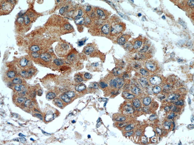 TPM2 Antibody in Immunohistochemistry (Paraffin) (IHC (P))