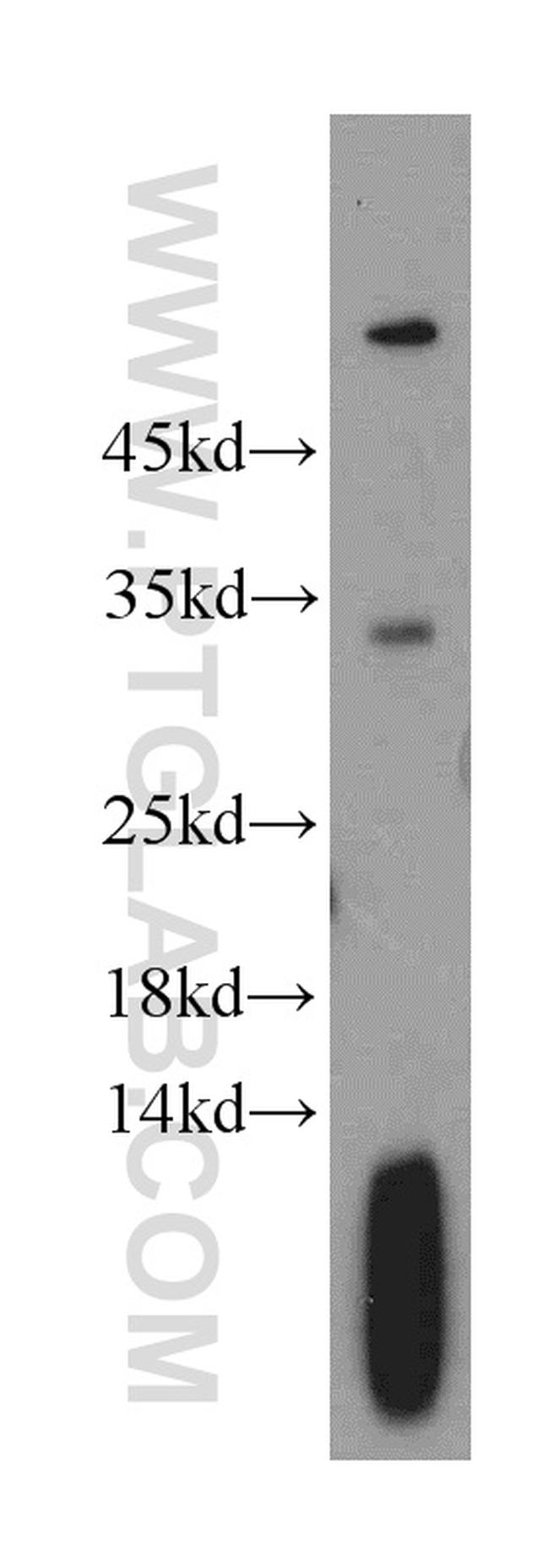 TPM2 Antibody in Western Blot (WB)