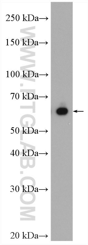 Transketolase Antibody in Western Blot (WB)