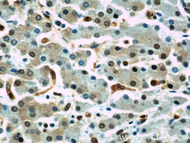 Transketolase Antibody in Immunohistochemistry (Paraffin) (IHC (P))