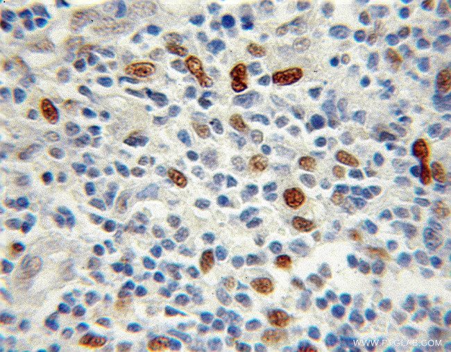 Transketolase Antibody in Immunohistochemistry (Paraffin) (IHC (P))