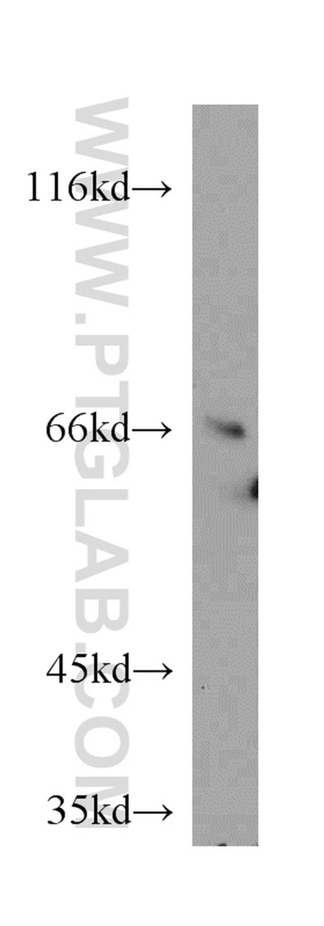 Transketolase Antibody in Western Blot (WB)