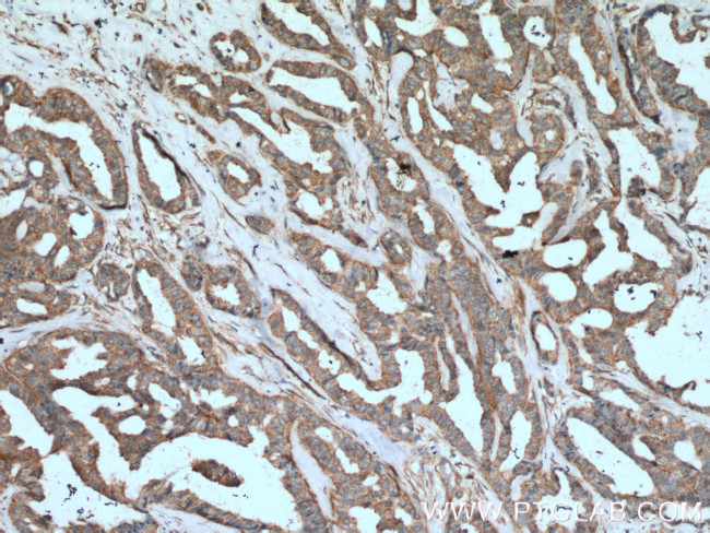 B4GALT3 Antibody in Immunohistochemistry (Paraffin) (IHC (P))