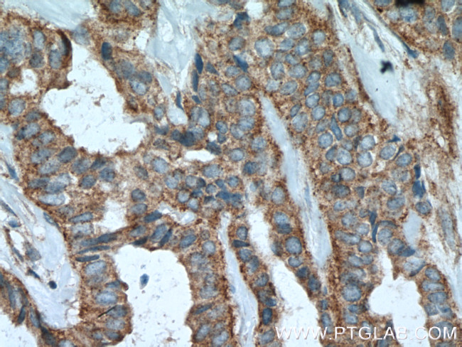 B4GALT3 Antibody in Immunohistochemistry (Paraffin) (IHC (P))