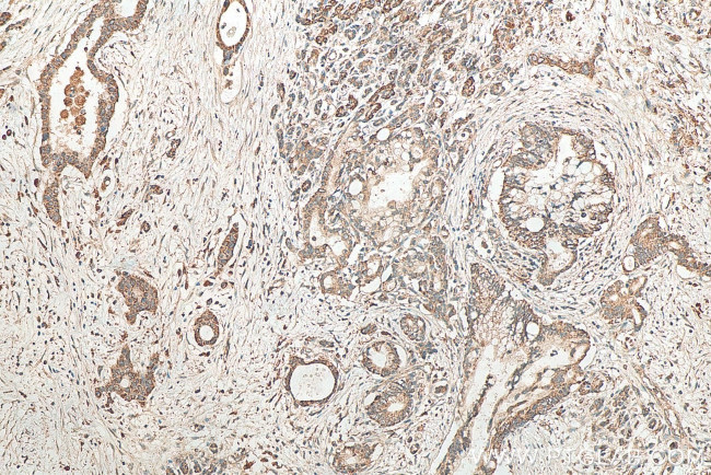 WBP1 Antibody in Immunohistochemistry (Paraffin) (IHC (P))