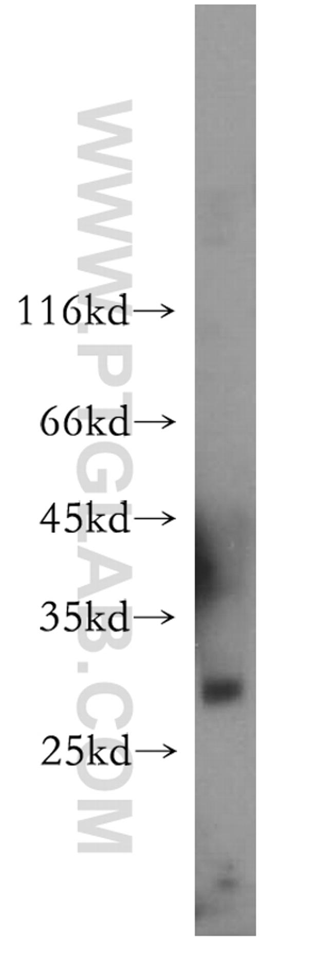 WBP1 Antibody in Western Blot (WB)