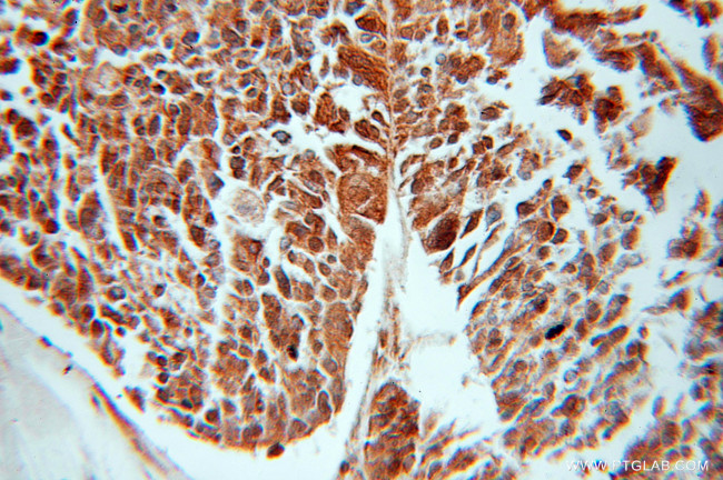 GNB5 Antibody in Immunohistochemistry (Paraffin) (IHC (P))