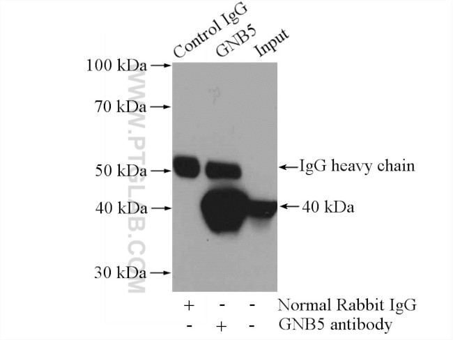 GNB5 Antibody in Immunoprecipitation (IP)