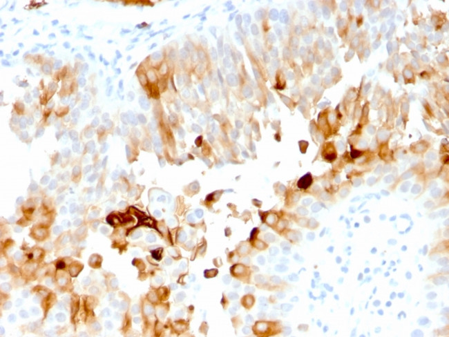 Uroplakin 1A Antibody in Immunohistochemistry (Paraffin) (IHC (P))