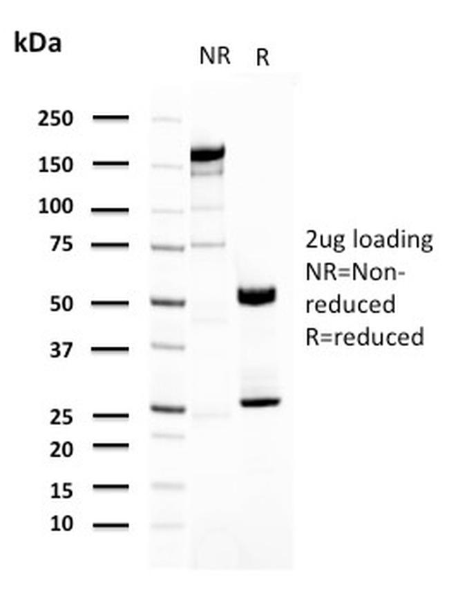 Uroplakin 1A Antibody in SDS-PAGE (SDS-PAGE)
