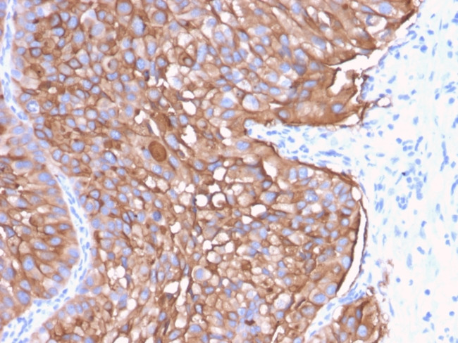 Uroplakin 1A Antibody in Immunohistochemistry (Paraffin) (IHC (P))