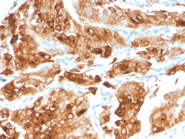 Uroplakin 1A Antibody in Immunohistochemistry (Paraffin) (IHC (P))