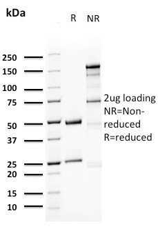 Uroplakin 1A (Urothelial Differentiation Marker) Antibody in SDS-PAGE (SDS-PAGE)