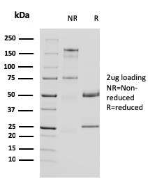 Uroplakin 1A (Urothelial Differentiation Marker) Antibody in SDS-PAGE (SDS-PAGE)