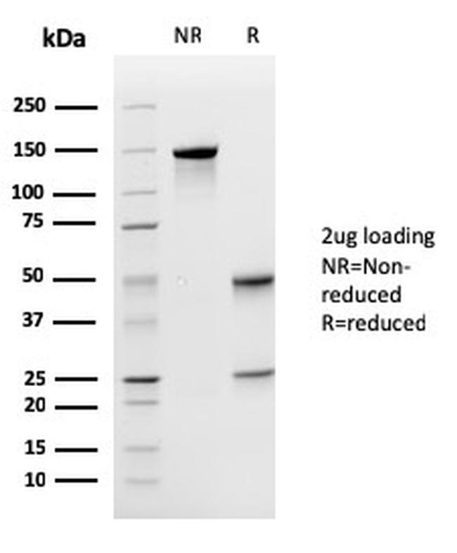 Uroplakin 1A Antibody in SDS-PAGE (SDS-PAGE)