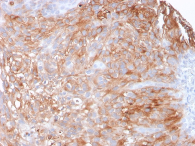 Uroplakin 1A Antibody in Immunohistochemistry (Paraffin) (IHC (P))