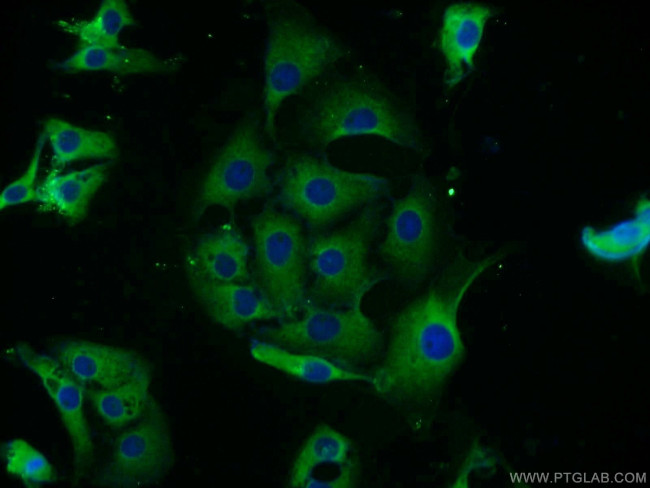 MEK2 Antibody in Immunocytochemistry (ICC/IF)