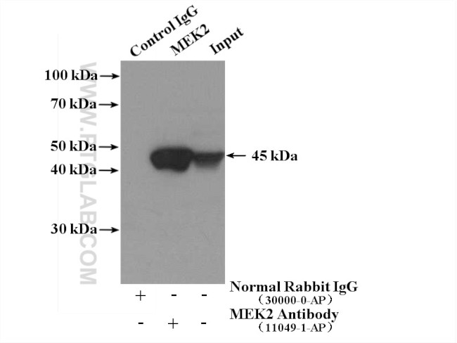 MEK2 Antibody in Immunoprecipitation (IP)