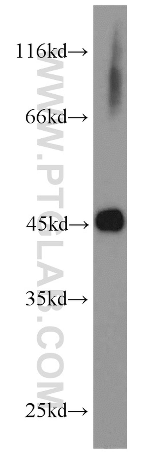 MEK2 Antibody in Western Blot (WB)